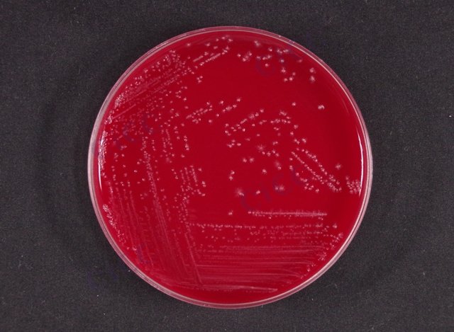 生孢梭菌 Clostridium sporogenes CICC 10385 Clostridium sporogenes