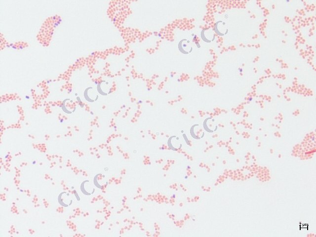 Enterobacter cloacae