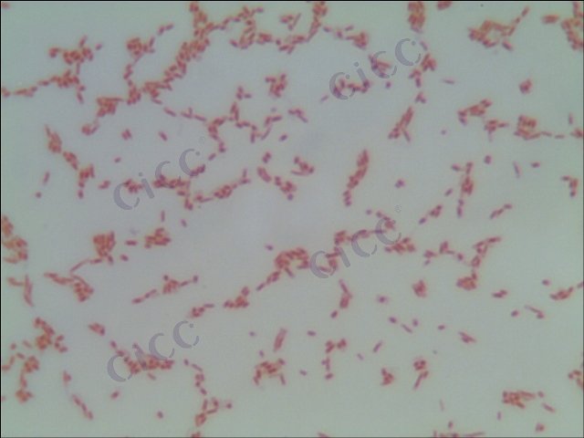 Salmonella enterica subsp enterica serotype Dakar