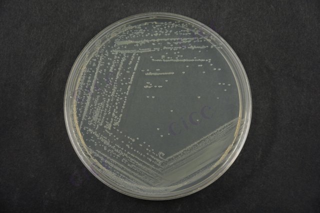 肠道集聚性大肠埃希氏菌 Escherichia coli EAEC CICC 24186 Escherichia coli EAEC