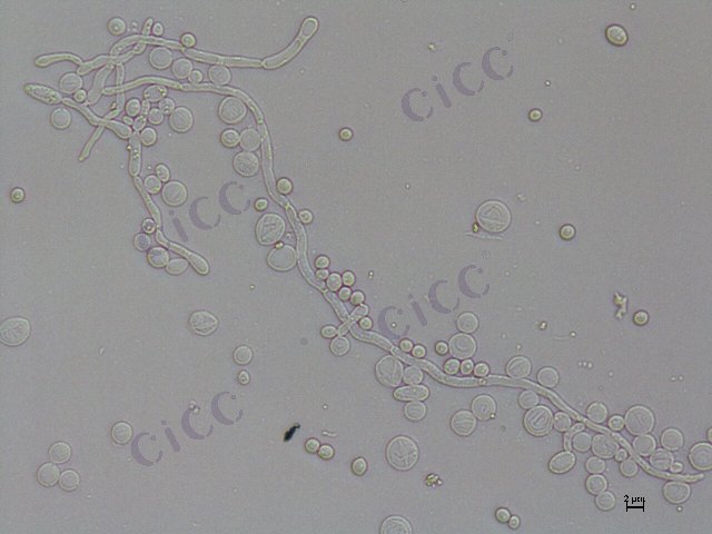 白假丝酵母 Candida albicans CICC 1944 Candida albicans