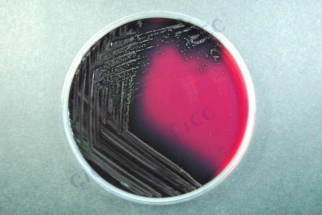 斯氏李斯特氏菌 Listeria seeligeri CICC 21671 Listeria seeligeri