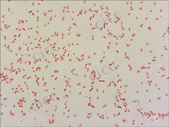 大肠埃希氏菌 Escherichia coli CICC 10354 Escherichia coli