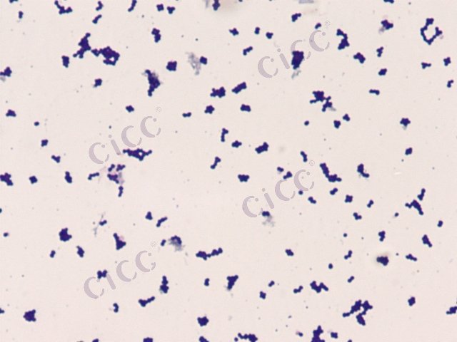 Microbacterium sp