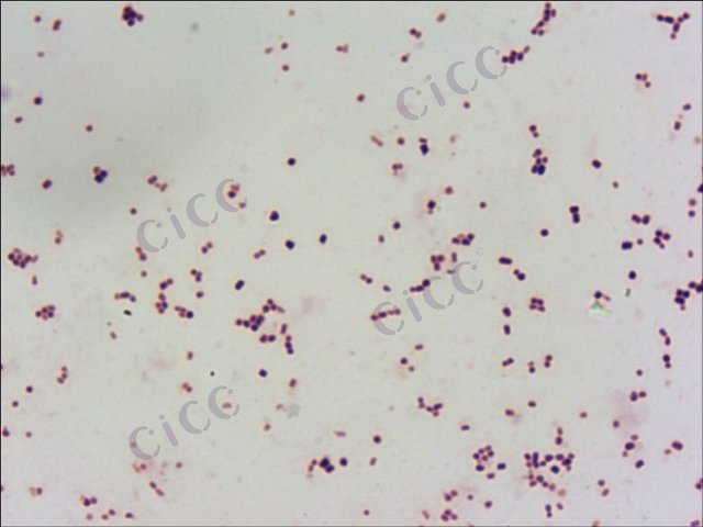 Streptomyces pratensis