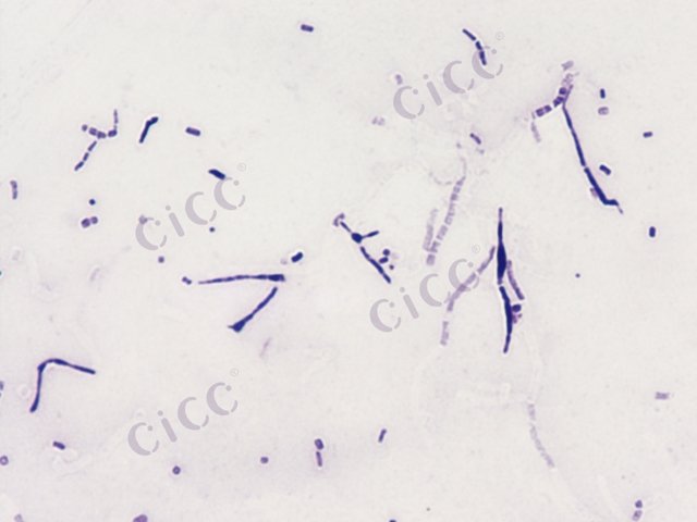 Streptomyces microflavus