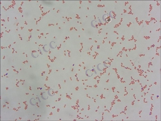 Serratia liquefaciens