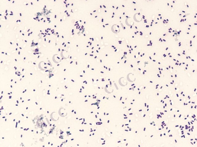 Enterobacter sakazakii