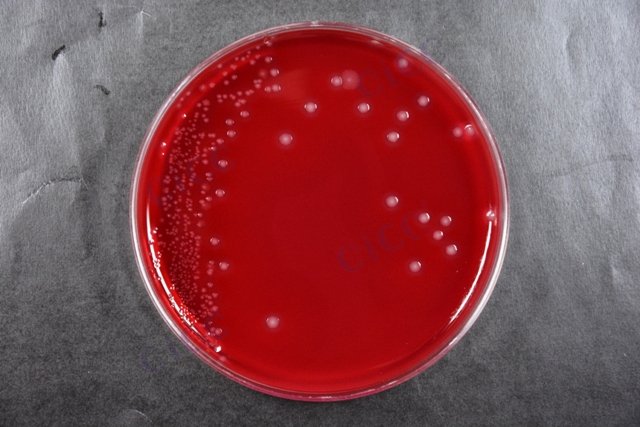 产气荚膜梭菌 Clostridium perfringens CICC 22949 Clostridium perfringens
