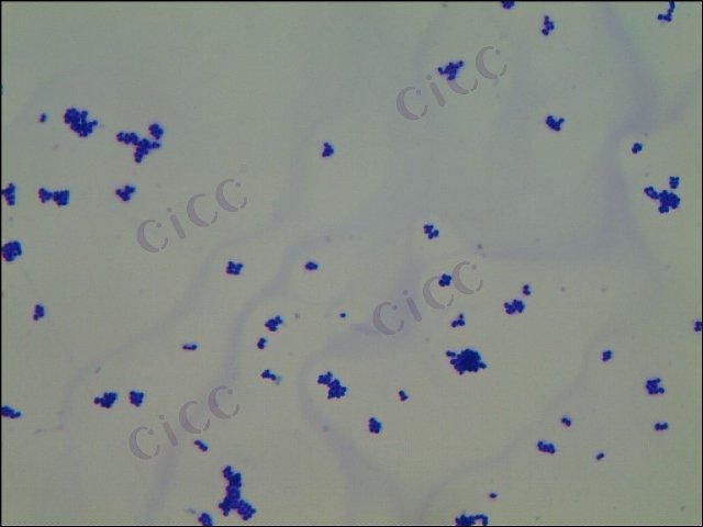 Corynebacterium ammoniagenes