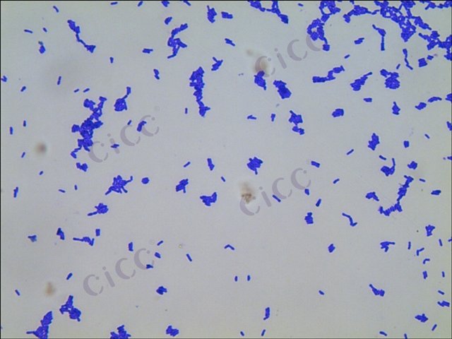 Bifidobacterium animalis subsp lactis