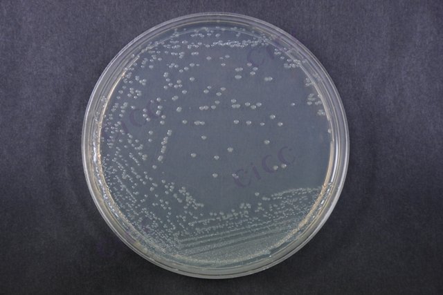肠道出血性大肠埃希氏菌 Escherichia coli EHEC O157:H7 CICC 21530 Escherichia coli EHEC O157:H7