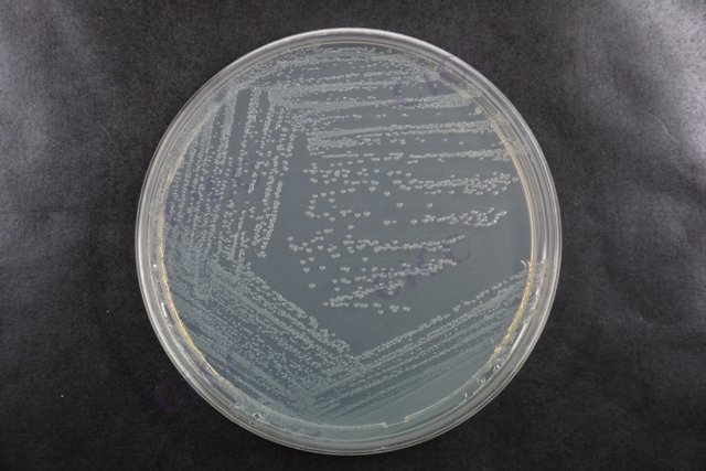 肠沙门氏菌肠亚种鼠伤寒血清型 Salmonella enterica subsp enterica serovar Typhimurium CICC 10420 Salmonella enterica subsp enterica serovar Typhimurium