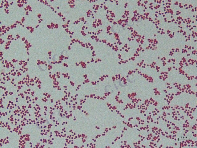 Acinetobacter sp