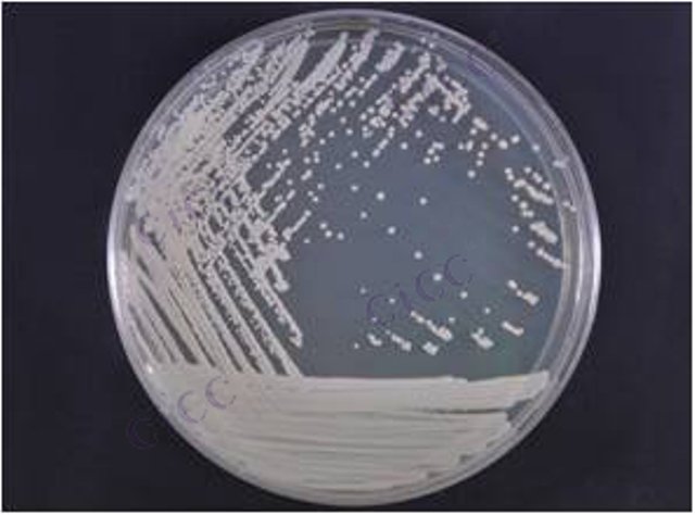 Brevibacterium sp