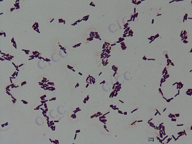Rummeliibacillus suwonensis