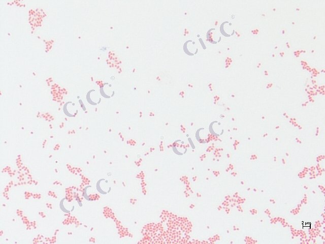 Enterobacter asburiae