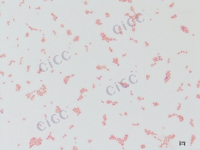 Salmonella enterica subsp enterica serovar Typhimurium