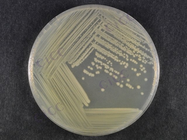 Citrobacter freundii