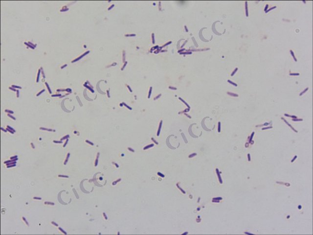 Lysinibacillus sphaericus