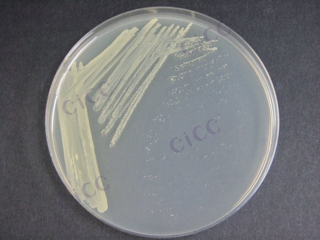 Corynebacterium ammoniagenes