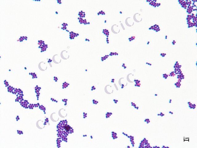 Enterococcus faecium