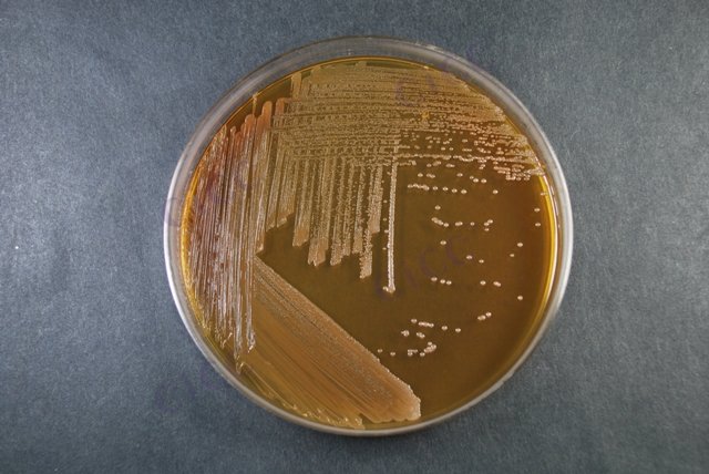 Acetobacter pasteurianus