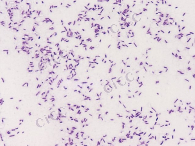 Salmonella enterica subsp enterica serovar Typhimurium