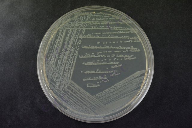 肠沙门氏菌肠亚种肠炎血清型 Salmonella enterica subsp enterica serovar Enteritidis CICC 10982 Salmonella enterica subsp enterica serovar Enteritidis