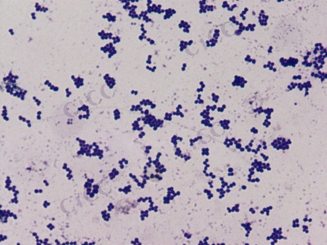 Brachybacterium sacelli