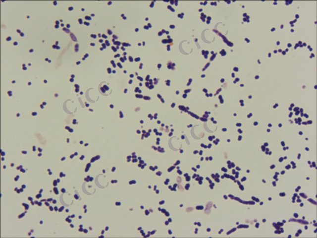 鲍氏不动杆菌 Acinetobacter baumannii CICC 10980 Acinetobacter baumannii