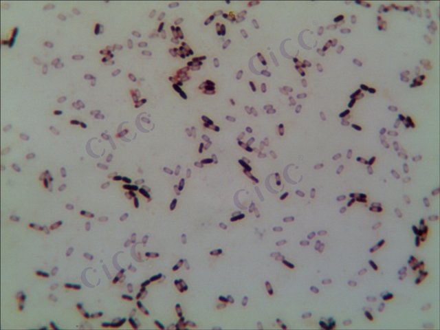 Bacillus subtilis subsp subtilis