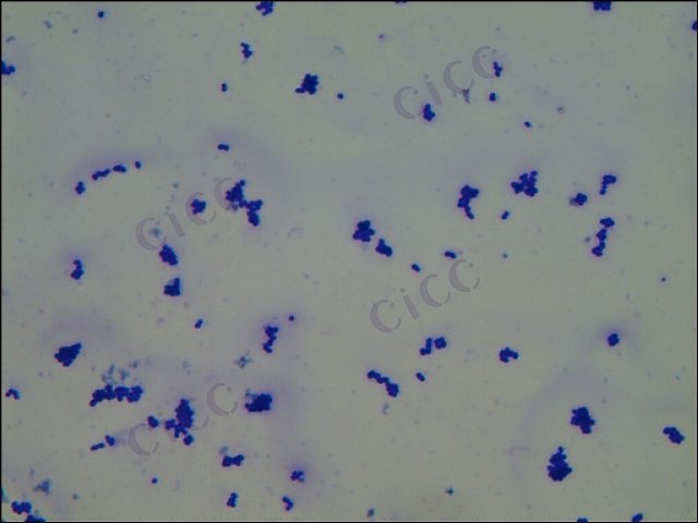 Corynebacterium ammoniagenes