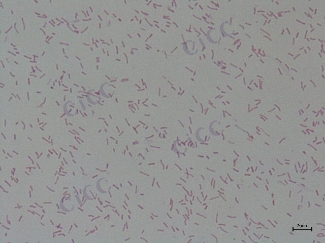 Vibrio parahaemolyticus