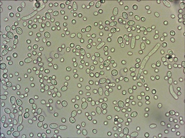 Candida tropicalis