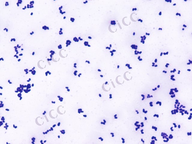 Corynebacterium glutamicum