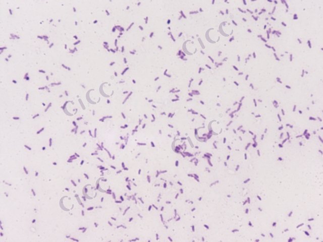 Salmonella enterica subsp enterica serovar Enteritidis