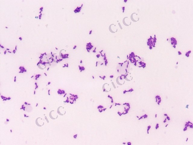 Microbacterium sp
