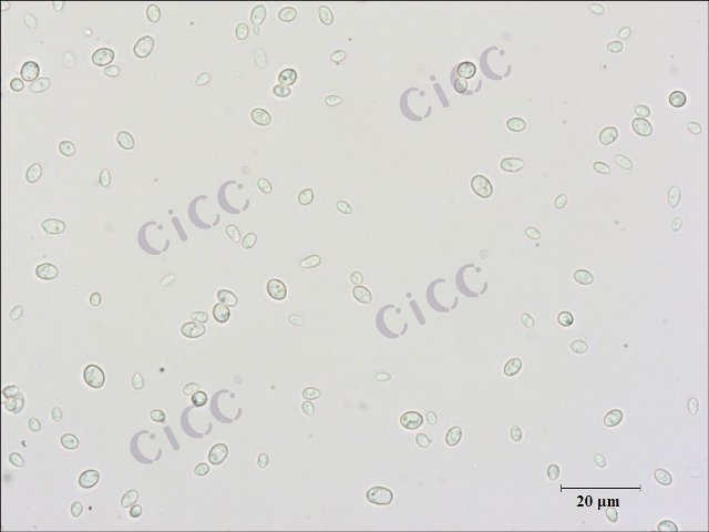 Saccharomyces cerevisiae