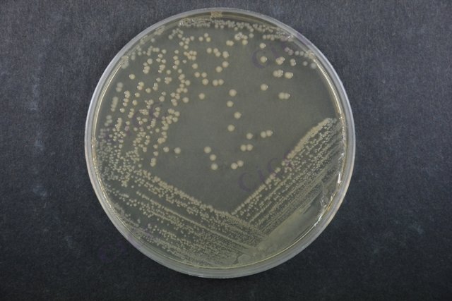 大肠埃希氏菌 Escherichia coli CICC 10389 Escherichia coli