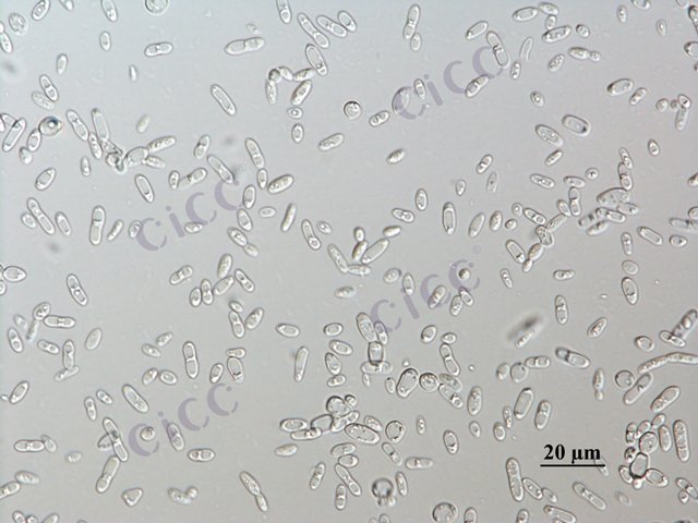 Saccharomyces cerevisiae