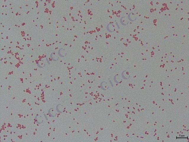 Vibrio parahaemolyticus