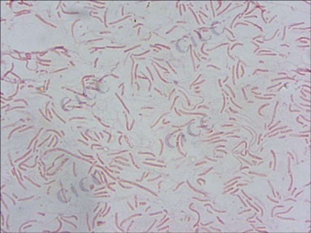 创伤弧菌 Vibrio vulnificus CICC 10383 Vibrio vulnificus