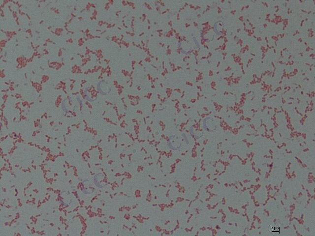 Serratia marcescens subsp marcescens