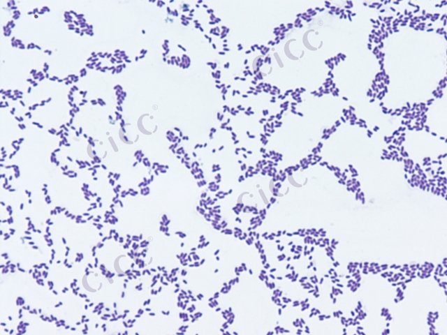 Pseudomonas aeruginosa