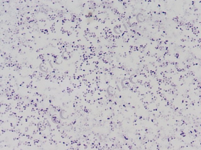 Serratia marcescens subsp sakuensis