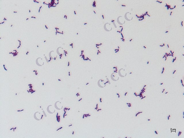 Gordonia hydrophobica