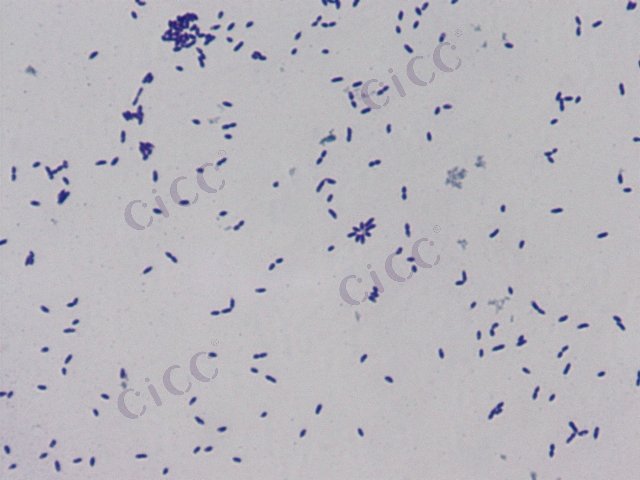 Sphingomonas wittichii