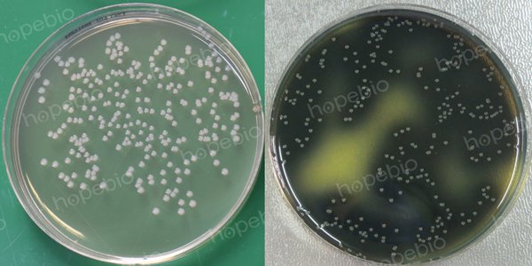 单增李斯特氏菌在LPM上的菌落形态（左侧未添加柠檬酸铁铵与七叶苷，右侧添加了柠檬酸铁铵与七叶苷）