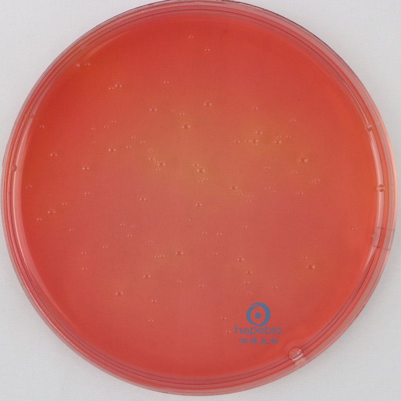 福氏志贺氏菌  无色菌落，无黑心